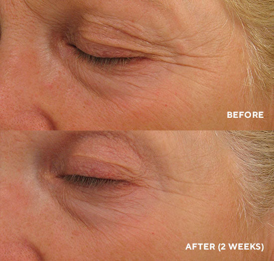 Hydropeptide - Eye Authority Cream